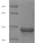 SDS-PAGE separation of QP5625 followed by commassie total protein stain results in a primary band consistent with reported data for Type-2 angiotensin II receptor. These data demonstrate Greater than 90% as determined by SDS-PAGE.