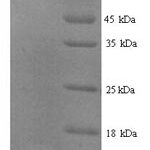 SDS-PAGE separation of QP5626 followed by commassie total protein stain results in a primary band consistent with reported data for Type-2 angiotensin II receptor. These data demonstrate Greater than 90% as determined by SDS-PAGE.