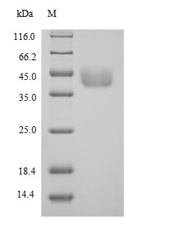 SDS-PAGE separation of QP5628 followed by commassie total protein stain results in a primary band consistent with reported data for Agxt