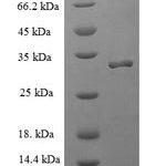 SDS-PAGE separation of QP5630 followed by commassie total protein stain results in a primary band consistent with reported data for Allograft inflammatory factor 1. These data demonstrate Greater than 90% as determined by SDS-PAGE.