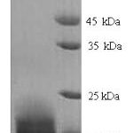 SDS-PAGE separation of QP5632 followed by commassie total protein stain results in a primary band consistent with reported data for Allograft inflammatory factor 1. These data demonstrate Greater than 90% as determined by SDS-PAGE.