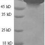 SDS-PAGE separation of QP5642 followed by commassie total protein stain results in a primary band consistent with reported data for Serum Albumin / HSA / ALB. These data demonstrate Greater than 90% as determined by SDS-PAGE.