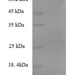 SDS-PAGE separation of QP5643 followed by commassie total protein stain results in a primary band consistent with reported data for Serum Albumin / HSA / ALB. These data demonstrate Greater than 90% as determined by SDS-PAGE.