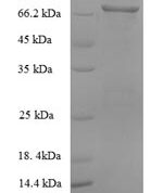 SDS-PAGE separation of QP5643 followed by commassie total protein stain results in a primary band consistent with reported data for Serum Albumin / HSA / ALB. These data demonstrate Greater than 90% as determined by SDS-PAGE.