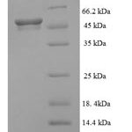 SDS-PAGE separation of QP5645 followed by commassie total protein stain results in a primary band consistent with reported data for ALDH5A1