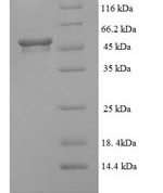 SDS-PAGE separation of QP5645 followed by commassie total protein stain results in a primary band consistent with reported data for ALDH5A1