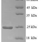 SDS-PAGE separation of QP5656 followed by commassie total protein stain results in a primary band consistent with reported data for Aldehyde oxidase. These data demonstrate Greater than 90% as determined by SDS-PAGE.