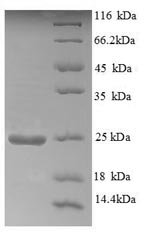 SDS-PAGE separation of QP5656 followed by commassie total protein stain results in a primary band consistent with reported data for Aldehyde oxidase. These data demonstrate Greater than 90% as determined by SDS-PAGE.