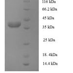 SDS-PAGE separation of QP5657 followed by commassie total protein stain results in a primary band consistent with reported data for AP-1 complex subunit sigma-3. These data demonstrate Greater than 90% as determined by SDS-PAGE.