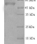 SDS-PAGE separation of QP5658 followed by commassie total protein stain results in a primary band consistent with reported data for AP-2 complex subunit mu. These data demonstrate Greater than 90% as determined by SDS-PAGE.