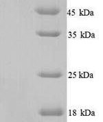 SDS-PAGE separation of QP5665 followed by commassie total protein stain results in a primary band consistent with reported data for Apolipoprotein C-II. These data demonstrate Greater than 90% as determined by SDS-PAGE.