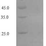 SDS-PAGE separation of QP5666 followed by commassie total protein stain results in a primary band consistent with reported data for Apolipoprotein C-III. These data demonstrate Greater than 90% as determined by SDS-PAGE.