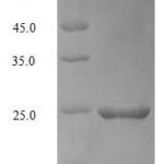 SDS-PAGE separation of QP5667 followed by commassie total protein stain results in a primary band consistent with reported data for Apolipoprotein C-III. These data demonstrate Greater than 90% as determined by SDS-PAGE.