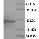 SDS-PAGE separation of QP5672 followed by commassie total protein stain results in a primary band consistent with reported data for Aquaporin-4. These data demonstrate Greater than 81% as determined by SDS-PAGE.