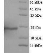 SDS-PAGE separation of QP5672 followed by commassie total protein stain results in a primary band consistent with reported data for Aquaporin-4. These data demonstrate Greater than 81% as determined by SDS-PAGE.