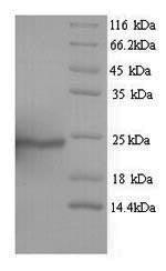 SDS-PAGE separation of QP5672 followed by commassie total protein stain results in a primary band consistent with reported data for Aquaporin-4. These data demonstrate Greater than 81% as determined by SDS-PAGE.