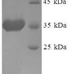 SDS-PAGE separation of QP5674 followed by commassie total protein stain results in a primary band consistent with reported data for ADP-ribosylation factor 6. These data demonstrate Greater than 90% as determined by SDS-PAGE.