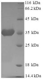 SDS-PAGE separation of QP5674 followed by commassie total protein stain results in a primary band consistent with reported data for ADP-ribosylation factor 6. These data demonstrate Greater than 90% as determined by SDS-PAGE.