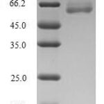 SDS-PAGE separation of QP5676 followed by commassie total protein stain results in a primary band consistent with reported data for Arginase-2