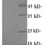 SDS-PAGE separation of QP5679 followed by commassie total protein stain results in a primary band consistent with reported data for Arylsulfatase B. These data demonstrate Greater than 90% as determined by SDS-PAGE.