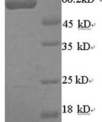 SDS-PAGE separation of QP5679 followed by commassie total protein stain results in a primary band consistent with reported data for Arylsulfatase B. These data demonstrate Greater than 90% as determined by SDS-PAGE.