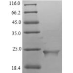 SDS-PAGE separation of QP5682 followed by commassie total protein stain results in a primary band consistent with reported data for Putative inactive neutral ceramidase B. These data demonstrate Greater than 90% as determined by SDS-PAGE.