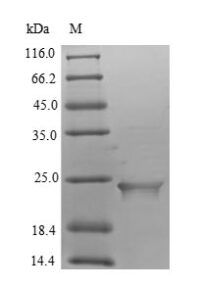 SDS-PAGE separation of QP5682 followed by commassie total protein stain results in a primary band consistent with reported data for Putative inactive neutral ceramidase B. These data demonstrate Greater than 90% as determined by SDS-PAGE.