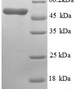 SDS-PAGE separation of QP5684 followed by commassie total protein stain results in a primary band consistent with reported data for ASGPR1 / ASGR1. These data demonstrate Greater than 90% as determined by SDS-PAGE.