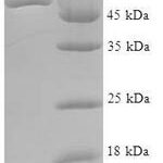 SDS-PAGE separation of QP5685 followed by commassie total protein stain results in a primary band consistent with reported data for ATPase ASNA1. These data demonstrate Greater than 90% as determined by SDS-PAGE.