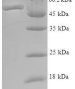 SDS-PAGE separation of QP5685 followed by commassie total protein stain results in a primary band consistent with reported data for ATPase ASNA1. These data demonstrate Greater than 90% as determined by SDS-PAGE.