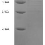 SDS-PAGE separation of QP5691 followed by commassie total protein stain results in a primary band consistent with reported data for ATP2A2. These data demonstrate Greater than 90% as determined by SDS-PAGE.