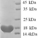 SDS-PAGE separation of QP5708 followed by commassie total protein stain results in a primary band consistent with reported data for BCHE / Butyrylcholinesterase. These data demonstrate Greater than 90% as determined by SDS-PAGE.