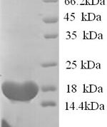 SDS-PAGE separation of QP5708 followed by commassie total protein stain results in a primary band consistent with reported data for BCHE / Butyrylcholinesterase. These data demonstrate Greater than 90% as determined by SDS-PAGE.