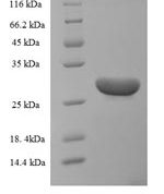SDS-PAGE separation of QP5714 followed by commassie total protein stain results in a primary band consistent with reported data for BDNF Protein. These data demonstrate Greater than 90% as determined by SDS-PAGE.