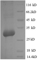 SDS-PAGE separation of QP5717 followed by commassie total protein stain results in a primary band consistent with reported data for Osteocalcin. These data demonstrate Greater than 82.2% as determined by SDS-PAGE.