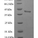 SDS-PAGE separation of QP5718 followed by commassie total protein stain results in a primary band consistent with reported data for BID Protein. These data demonstrate Greater than 90% as determined by SDS-PAGE.