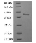 SDS-PAGE separation of QP5718 followed by commassie total protein stain results in a primary band consistent with reported data for BID Protein. These data demonstrate Greater than 90% as determined by SDS-PAGE.