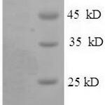 SDS-PAGE separation of QP5722 followed by commassie total protein stain results in a primary band consistent with reported data for Bone morphogenetic protein 1. These data demonstrate Greater than 90% as determined by SDS-PAGE.