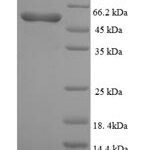 SDS-PAGE separation of QP5725 followed by commassie total protein stain results in a primary band consistent with reported data for ALK-3 / BMPR1A. These data demonstrate Greater than 90% as determined by SDS-PAGE.