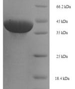 SDS-PAGE separation of QP5729 followed by commassie total protein stain results in a primary band consistent with reported data for BTN3A1 / CD277. These data demonstrate Greater than 90% as determined by SDS-PAGE.