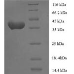 SDS-PAGE separation of QP5732 followed by commassie total protein stain results in a primary band consistent with reported data for Anaphase-promoting complex subunit 15. These data demonstrate Greater than 90% as determined by SDS-PAGE.