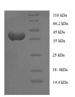 SDS-PAGE separation of QP5732 followed by commassie total protein stain results in a primary band consistent with reported data for Anaphase-promoting complex subunit 15. These data demonstrate Greater than 90% as determined by SDS-PAGE.