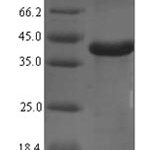 SDS-PAGE separation of QP5736 followed by commassie total protein stain results in a primary band consistent with reported data for Complement C1q subcomponent subunit A. These data demonstrate Greater than 90% as determined by SDS-PAGE.