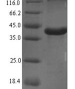 SDS-PAGE separation of QP5736 followed by commassie total protein stain results in a primary band consistent with reported data for Complement C1q subcomponent subunit A. These data demonstrate Greater than 90% as determined by SDS-PAGE.