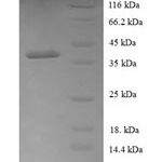 SDS-PAGE separation of QP5738 followed by commassie total protein stain results in a primary band consistent with reported data for COA1. These data demonstrate Greater than 90% as determined by SDS-PAGE.