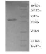 SDS-PAGE separation of QP5738 followed by commassie total protein stain results in a primary band consistent with reported data for COA1. These data demonstrate Greater than 90% as determined by SDS-PAGE.