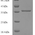 SDS-PAGE separation of QP5739 followed by commassie total protein stain results in a primary band consistent with reported data for Complement component C8 gamma chain. These data demonstrate Greater than 90% as determined by SDS-PAGE.