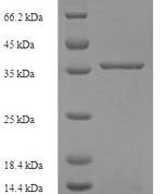 SDS-PAGE separation of QP5739 followed by commassie total protein stain results in a primary band consistent with reported data for Complement component C8 gamma chain. These data demonstrate Greater than 90% as determined by SDS-PAGE.