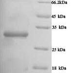 SDS-PAGE separation of QP5740 followed by commassie total protein stain results in a primary band consistent with reported data for Carbonic anhydrase 1. These data demonstrate Greater than 90% as determined by SDS-PAGE.