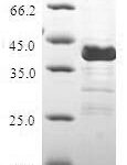 SDS-PAGE separation of QP5747 followed by commassie total protein stain results in a primary band consistent with reported data for CALCB / CGPR / Calcitonin 2. These data demonstrate Greater than 80% as determined by SDS-PAGE.